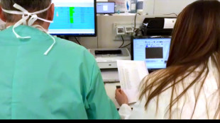 Allo studio nuovi sensori per leggere il cervello neurone per neurone