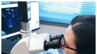 Trovato il freno che blocca la rigenerazione dopo le lesioni nervose