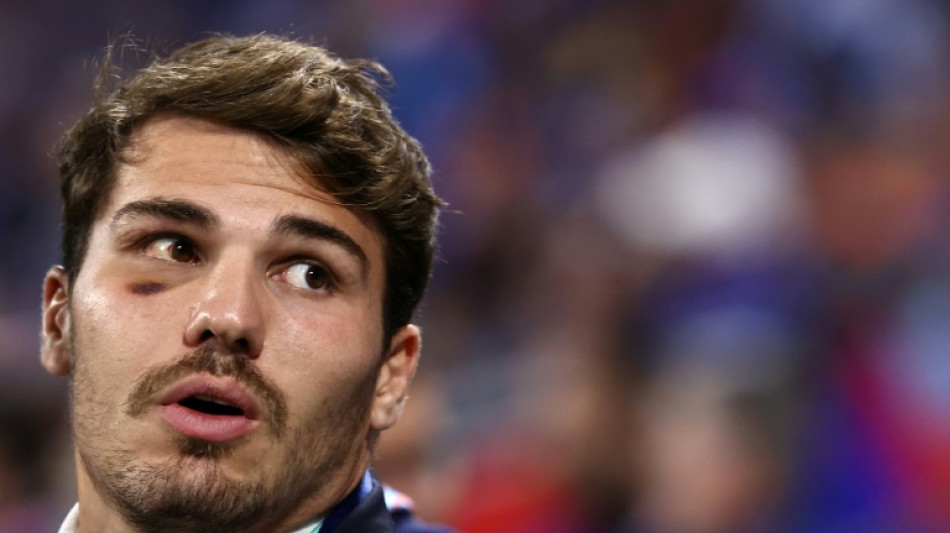 Dupont gets surgeon's green light to resume full training - federation