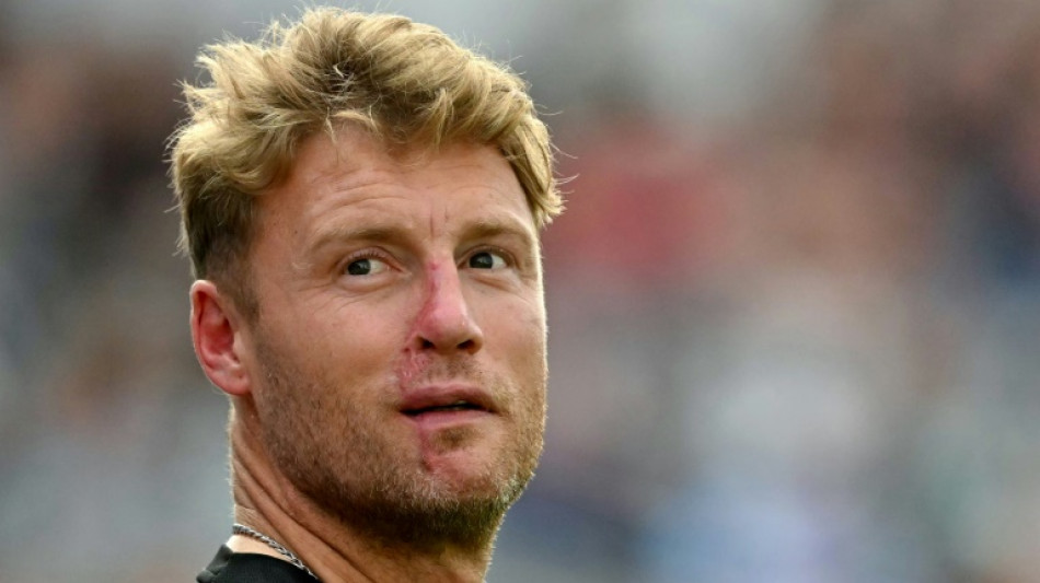 Former England star Flintoff reveals mental battle after car crash