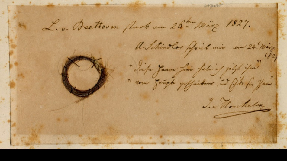DNA analysis of Beethoven's hair provides clues to his death